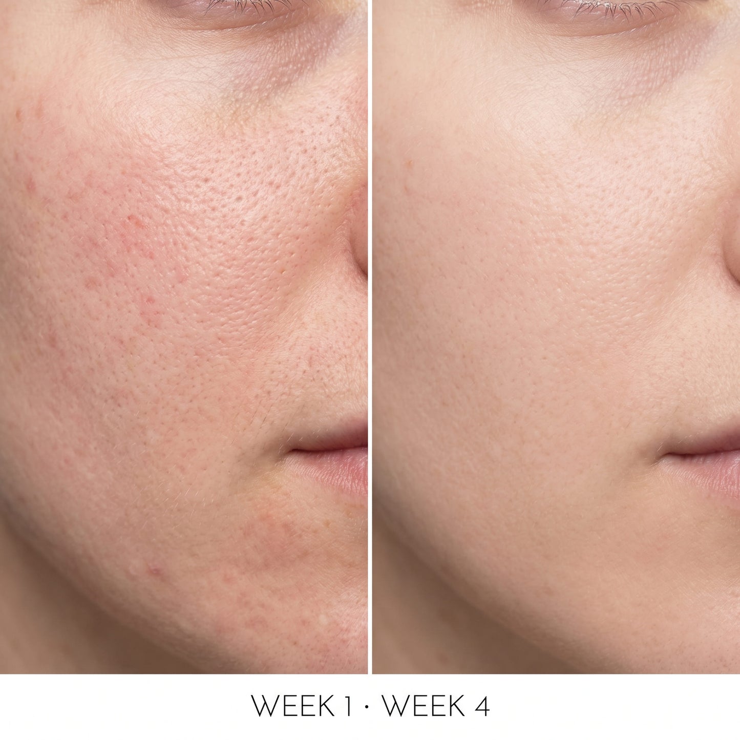 10% Niacinamide Serum