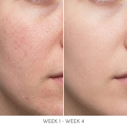 10% Niacinamide Serum